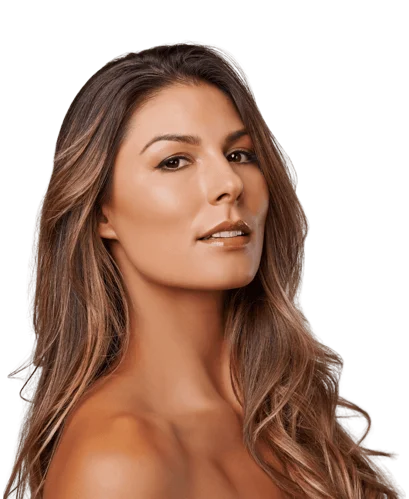 Mulher com resultado natural de aplicação de toxina botulínica